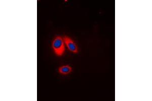 Immunofluorescent analysis of p47 phox (pS359) staining in HeLa cells. (NCF1 Antikörper  (C-Term, pSer359))