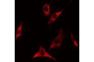 ABIN6275318 staining A549 cells by IF/ICC. (NARFL Antikörper  (Internal Region))