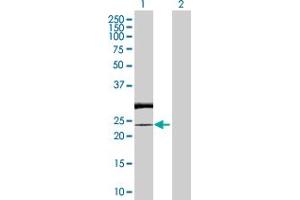 Western Blot analysis of RAB7L1 expression in transfected 293T cell line by RAB7L1 MaxPab polyclonal antibody.