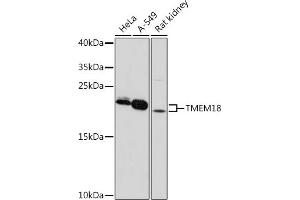 Western blot analysis of extracts of various cell lines, using TMEM18 pAb (ABIN7270961) at 1:1000 dilution. (Transmembrane Protein 18 (TMM18) (AA 40-100) Antikörper)