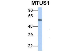 Western Blotting (WB) image for anti-Microtubule Associated Tumor Suppressor 1 (MTUS1) (Middle Region) antibody (ABIN2781855)