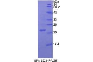 SDS-PAGE of Protein Standard from the Kit (Highly purified E. (ENOS ELISA Kit)