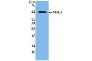 Detection of Recombinant AST, Human using Polyclonal Antibody to Aspartate Aminotransferase (AST) (GOT1 Antikörper  (AA 1-413))