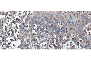 Immunohistochemistry of paraffin-embedded Human tonsil tissue using ZNHIT1 Polyclonal Antibody at dilution of 1:40(x200) (ZNHIT1 Antikörper)
