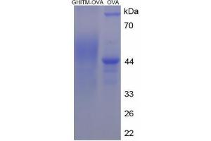 Image no. 2 for Growth Hormone Inducible Transmembrane Protein (GHITM) peptide (Ovalbumin) (ABIN5666210)