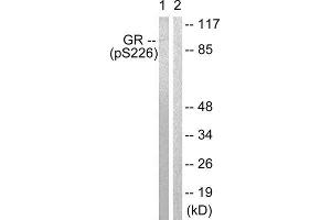 Western Blotting (WB) image for anti-GR (Internal Region), (pSer226), (pSer234), (pSer246) antibody (ABIN1847260) (GR (Internal Region), (pSer226), (pSer234), (pSer246) Antikörper)