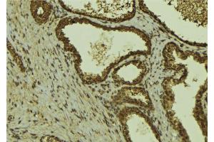 Immunohistochemistry (IHC) image for anti-TAF15 RNA Polymerase II, TATA Box Binding Protein (TBP)-Associated Factor, 68kDa (TAF15) (Internal Region) antibody (ABIN6259209)