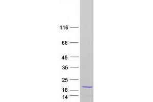 Validation with Western Blot (MAX Protein (Transcript Variant 3) (Myc-DYKDDDDK Tag))