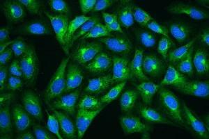 IF analysis of HSP27 using anti-HSP27 antibody (ABIN3042464).
