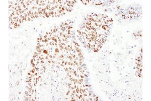 Immunohistochemistry (IHC) image for anti-PSME3 (PSME3) (AA 204-254) antibody (ABIN7454979) (PSME3 Antikörper  (AA 204-254))