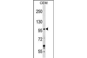 Western blot analysis in CEM cell line lysates (35ug/lane). (GREB1 Antikörper  (AA 1417-1446))