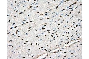 Immunohistochemical staining of paraffin-embedded liver tissue using anti-BSG mouse monoclonal antibody. (CD147 Antikörper)