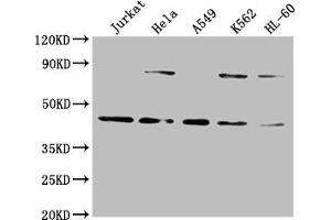 Western Blot Positive WB detected in: Jurkat whole cell lysate, Hela whole cell lysate, A549 whole cell lysate, K562 whole cell lysate, HL60 whole cell lysate All lanes: LMX1A antibody at 1:2000 Secondary Goat polyclonal to rabbit IgG at 1/50000 dilution Predicted band size: 43, 15 kDa Observed band size: 43 kDa (LMX1A Antikörper  (AA 9-86))