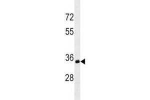Western Blotting (WB) image for anti-Membrane-Spanning 4-Domains, Subfamily A, Member 1 (MS4A1) (AA 266-294) antibody (ABIN3031750)