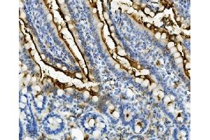 IHC analysis of ANPEP using anti-ANPEP antibody (ABIN7600087).