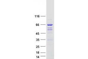 Western Blotting (WB) image for rho GTPase Activating Protein 9 (ARHGAP9) (Transcript Variant 3) protein (Myc-DYKDDDDK Tag) (ABIN2714885)