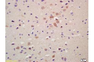 Formalin-fixed and paraffin embedded rat brain labeled with Anti-GRK1 Polyclonal Antibody, Unconjugated (ABIN737391) at 1:200 followed by conjugation to the secondary antibody and DAB staining. (GRK1 Antikörper)