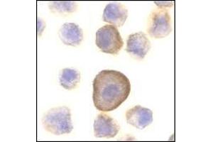 Immunocytochemistry of PERP in A431 cells with this product at 10 μg/ml.