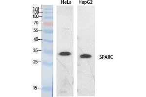 Western Blotting (WB) image for anti-Secreted Protein, Acidic, Cysteine-Rich (Osteonectin) (SPARC) (Internal Region) antibody (ABIN6281361)