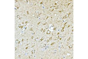 Immunohistochemistry of paraffin-embedded rat brain using GPLD1 Rabbit pAb (ABIN6131716, ABIN6141335, ABIN6141336 and ABIN6222300) at dilution of 1:100 (40x lens). (GPLD1 Antikörper  (AA 24-160))