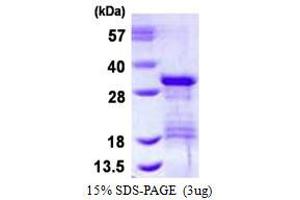 Image no. 1 for Vesicle Transport through Interaction with T-SNAREs Homolog 1B (VTI1B) (AA 1-208) protein (His tag) (ABIN6386970)