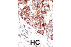 Immunohistochemistry (IHC) image for anti-Protein Inhibitor of Activated STAT, 1 (PIAS1) antibody (ABIN2996746) (PIAS1 Antikörper)