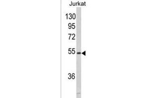 Western blot analysis of MF 928b in Jurkat cell line lysates (35 μg/lane).