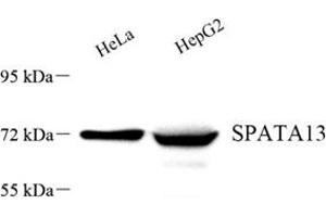 Western blot analysis of SPATA13 (ABIN7075700) at dilution of 1: 500