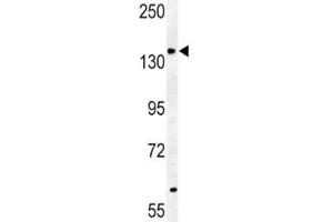 ABCB4-S639 western blot analysis in mouse heart tissue lysate