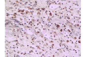 Formalin-fixed and paraffin embedded rat colon tissue labeled with Anti-PAF Polyclonal Antibody, Unconjugated (ABIN737931) at 1:200 followed by conjugation to the secondary antibody and DAB staining (KIAA0101 Antikörper)