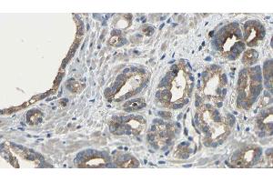 ABIN6275481 at 1/100 staining Human prostate tissue by IHC-P. (RGS5 Antikörper  (Internal Region))