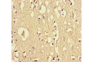 Immunohistochemistry of paraffin-embedded human brain tissue using ABIN7149595 at dilution of 1:100 (DOCK6 Antikörper  (AA 499-616))