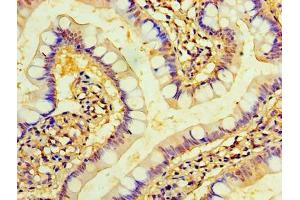 Immunohistochemistry of paraffin-embedded human small intestine tissue using ABIN7173221 at dilution of 1:100 (TMEM44 Antikörper  (AA 269-439))