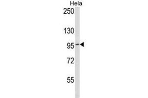BCL6 Antibody (C-term) western blot analysis in Hela cell line lysates (35µg/lane). (BCL6 Antikörper  (C-Term))
