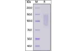 Human CD96 (C110S), His Tag on  under reducing (R) condition. (CD96 Protein (CD96) (AA 22-503) (His tag))