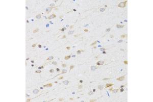 Immunohistochemistry of paraffin-embedded rat brain using CHRM5 antibody (ABIN5973103) at dilution of 1/100 (40x lens). (CHRM5 Antikörper)