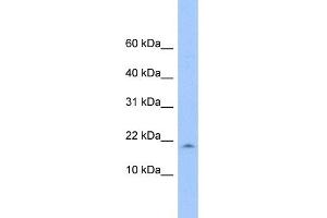 WB Suggested Anti-LOC285033 Antibody Titration: 0.