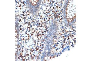 Immunohistochemistry of paraffin-embedded human appendix using LM Rabbit mAb (ABIN7268205) at dilution of 1:100 (40x lens).