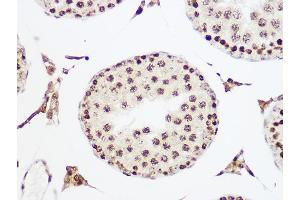 Immunohistochemistry of paraffin-embedded rat testis using MCM5 Rabbit mAb (ABIN7268543) at dilution of 1:100 (40x lens). (MCM5 Antikörper)