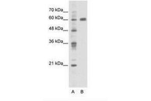 Image no. 1 for anti-PDZ and LIM Domain 5 (PDLIM5) (C-Term) antibody (ABIN202798) (PDLIM5 Antikörper  (C-Term))