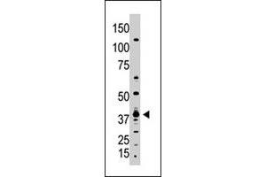 The GDF1 polyclonal antibody  is used in Western blot to detect GDF1 in A-375 cell lysate. (GDF1 Antikörper  (N-Term))