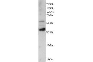 Western Blotting (WB) image for Protein Phosphatase 2, Regulatory Subunit B', epsilon Isoform (PPP2R5E) peptide (ABIN369415)