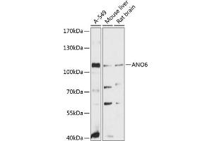 Western blot analysis of extracts of various cell lines, using  antibody (ABIN6129707, ABIN6136907, ABIN6136908 and ABIN6215620) at 1:3000 dilution. (Anoctamin 6 Antikörper  (AA 750-830))