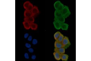 ABIN6261448 and ABIN6277528 staining Hela cells(30 min of UV treatment) by IF/ICC.