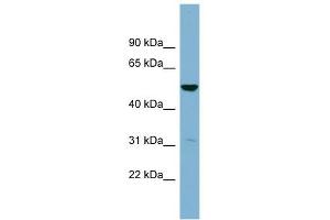 SDSL antibody used at 1 ug/ml to detect target protein. (SDSL Antikörper  (Middle Region))