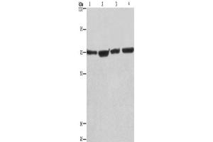 Western Blotting (WB) image for anti-Kruppel-Like Factor 11 (KLF11) antibody (ABIN2428323) (KLF11 Antikörper)