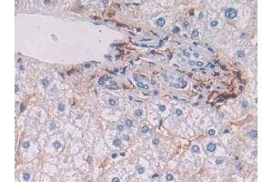 Immunohistochemistry (IHC) image for anti-Major Histocompatibility Complex, Class II, DR beta 1 (HLA-DRB1) (AA 30-266) antibody (ABIN7440764)