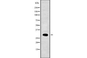 Western blot analysis NKX22 using Jurkat whole cell lysates (Nkx2-2 Antikörper  (Internal Region))
