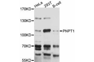Western blot analysis of extracts of various cell lines, using PNPT1 antibody (ABIN5998548) at 1:3000 dilution. (PNPT1 Antikörper)