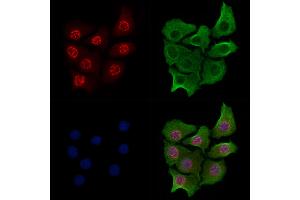 Phospho-RPA32/RPA2 (Ser4/Ser8) Antibody staining Hela cells(heat shock treatment) by IF/ICC. (RPA2 Antikörper  (pSer4, pSer8))